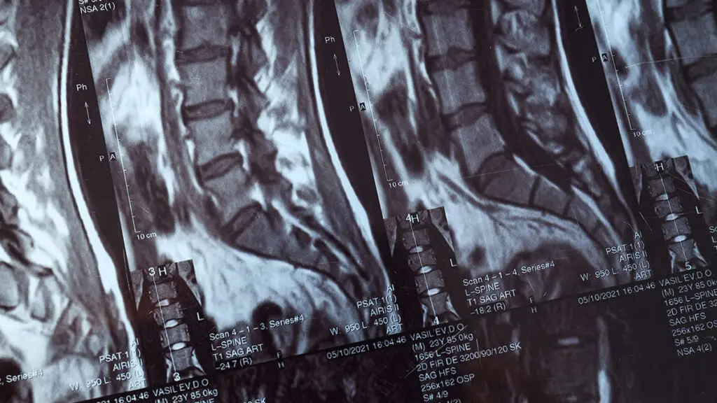 visita colonna vertebrale roma – tecnologie avanzate e trattamenti personalizzati