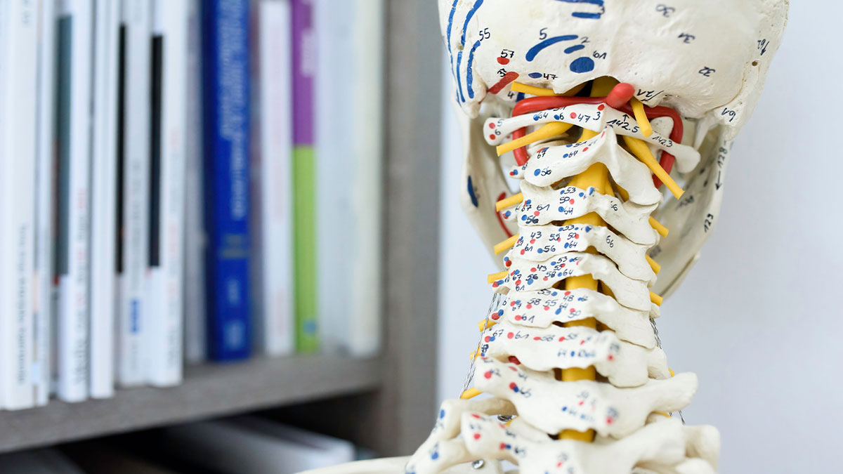 Ernia del Disco Cervicale: Sintomi, Diagnosi e Trattamento